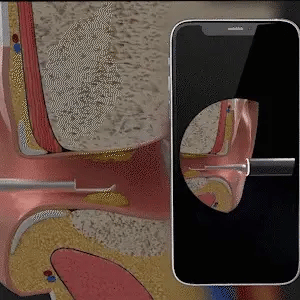 ClearCam Ear Cleaner