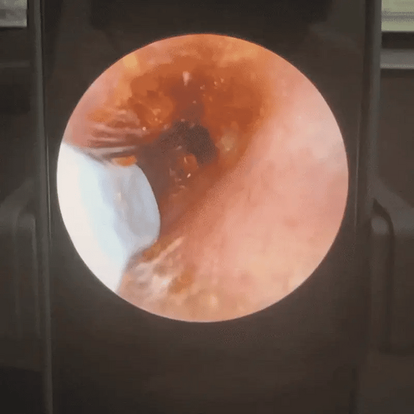 ClearCam Ear Cleaner